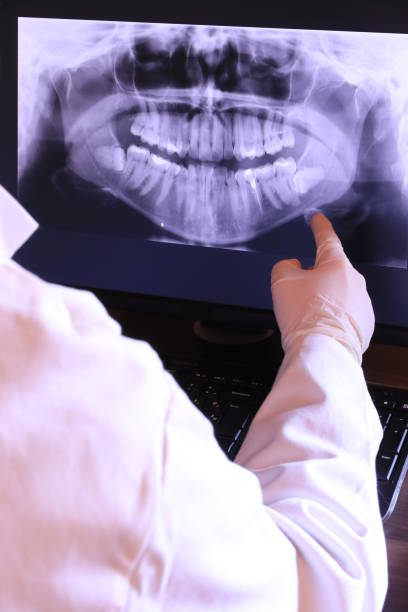 Best Emergency Tooth Extraction in Douglass Hills, KY